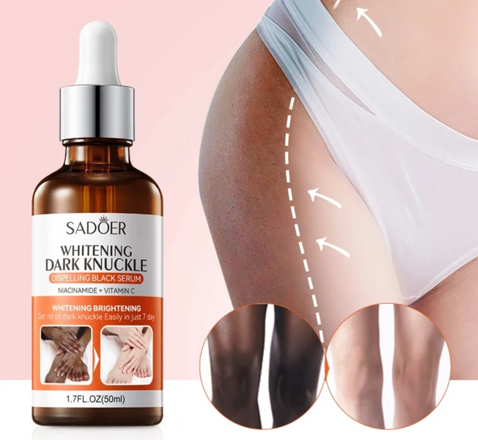 SADOER Dark Knuckle Whitening Serum – Niacinamide + Vitamin C 50ml