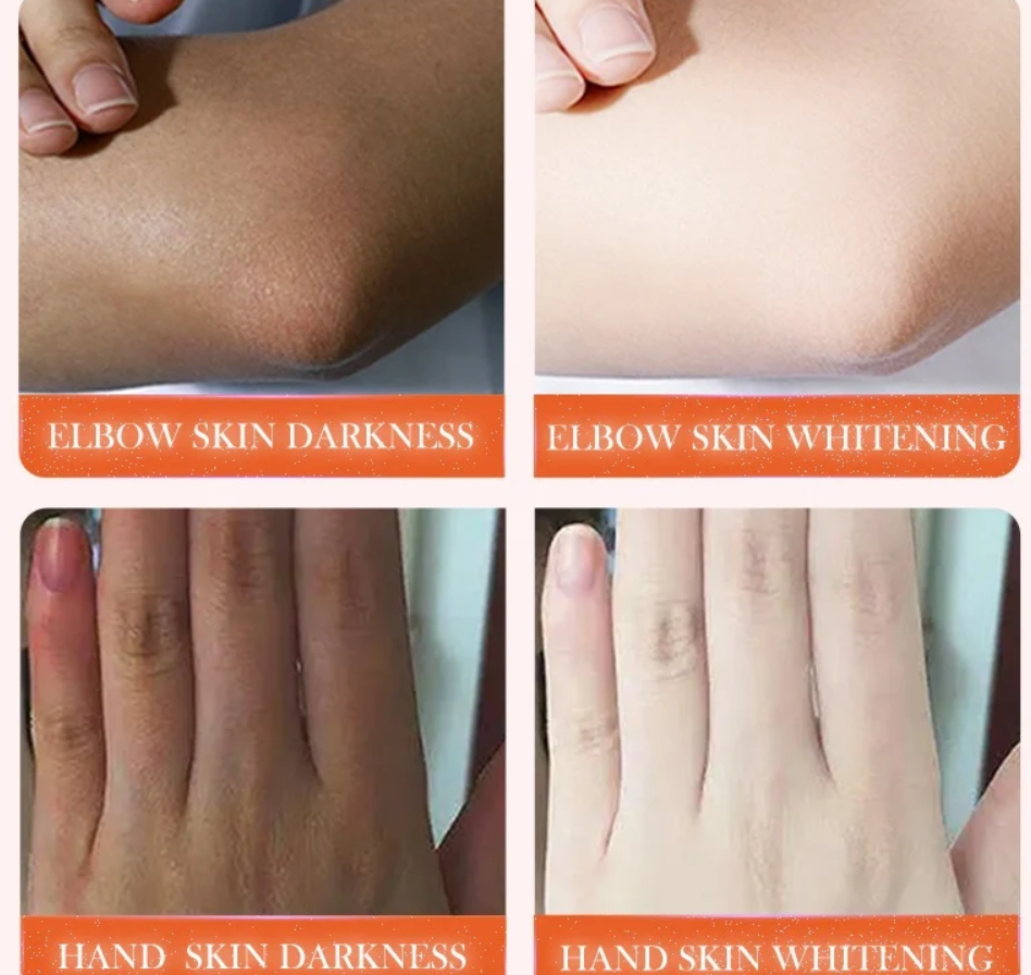 SADOER Dark Knuckle Whitening Serum – Niacinamide + Vitamin C 50ml